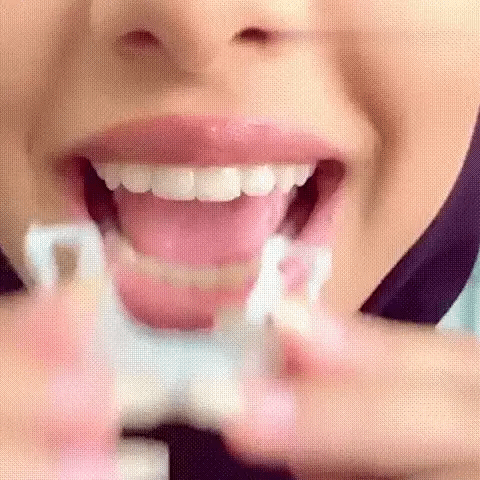 Mujer sonriendo con las carillas dentales removibles